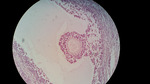 MISSING THUMBNAIL